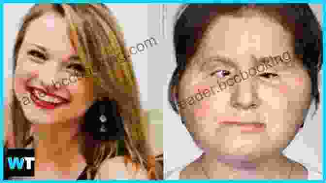 A Photo Of A Woman With A New Face After A Face Transplant Surgery. The Match: Complete Strangers A Miracle Face Transplant Two Lives Transformed