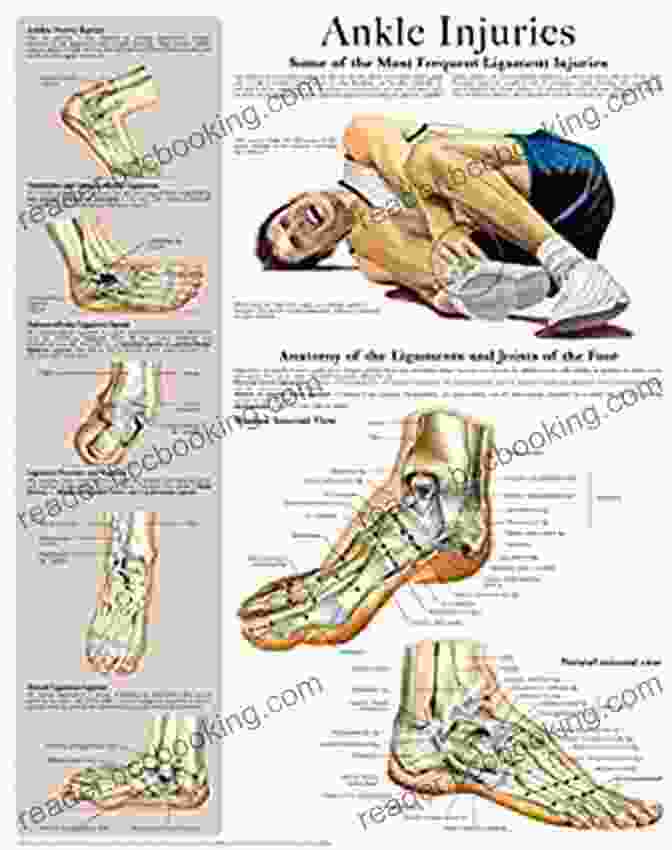 Ankle Injuries Chart Quick Reference Guide Ankle Injuries E Chart: Quick Reference Guide