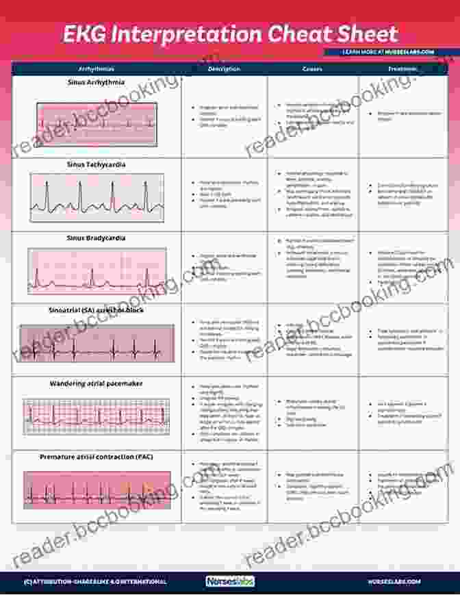 EKG Interpretation Guide Cover How To Read EKG/ECG Strips: A Step By Step Guide For Students To Quickly Interpret The 12 Lead ECG Learn How To Detect Early Signs Of Heart Attack Arrhythmias Heart Failure And Other Anomalies