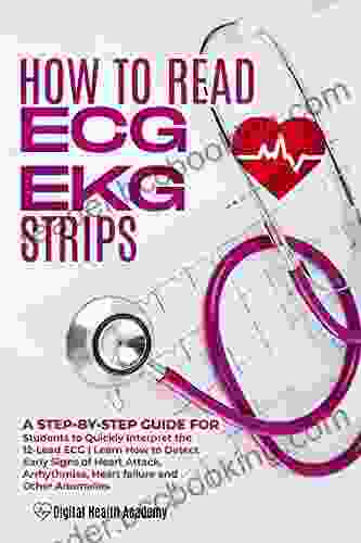 How To Read EKG/ECG Strips: A Step By Step Guide For Students To Quickly Interpret The 12 Lead ECG Learn How To Detect Early Signs Of Heart Attack Arrhythmias Heart Failure And Other Anomalies
