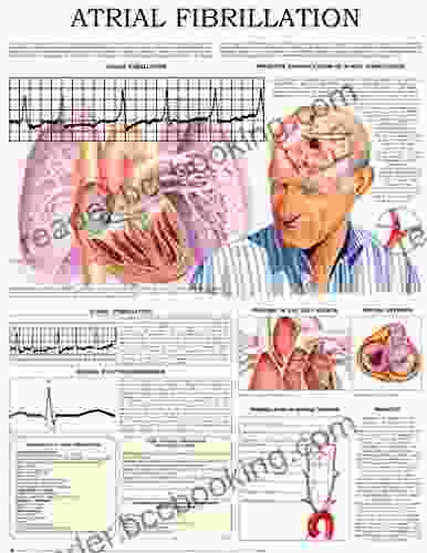 Atrial Fibrillation E Chart: Quick Reference Guide